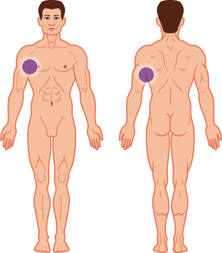 Arms / Underarms
