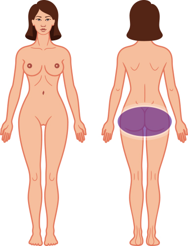 Buttocks