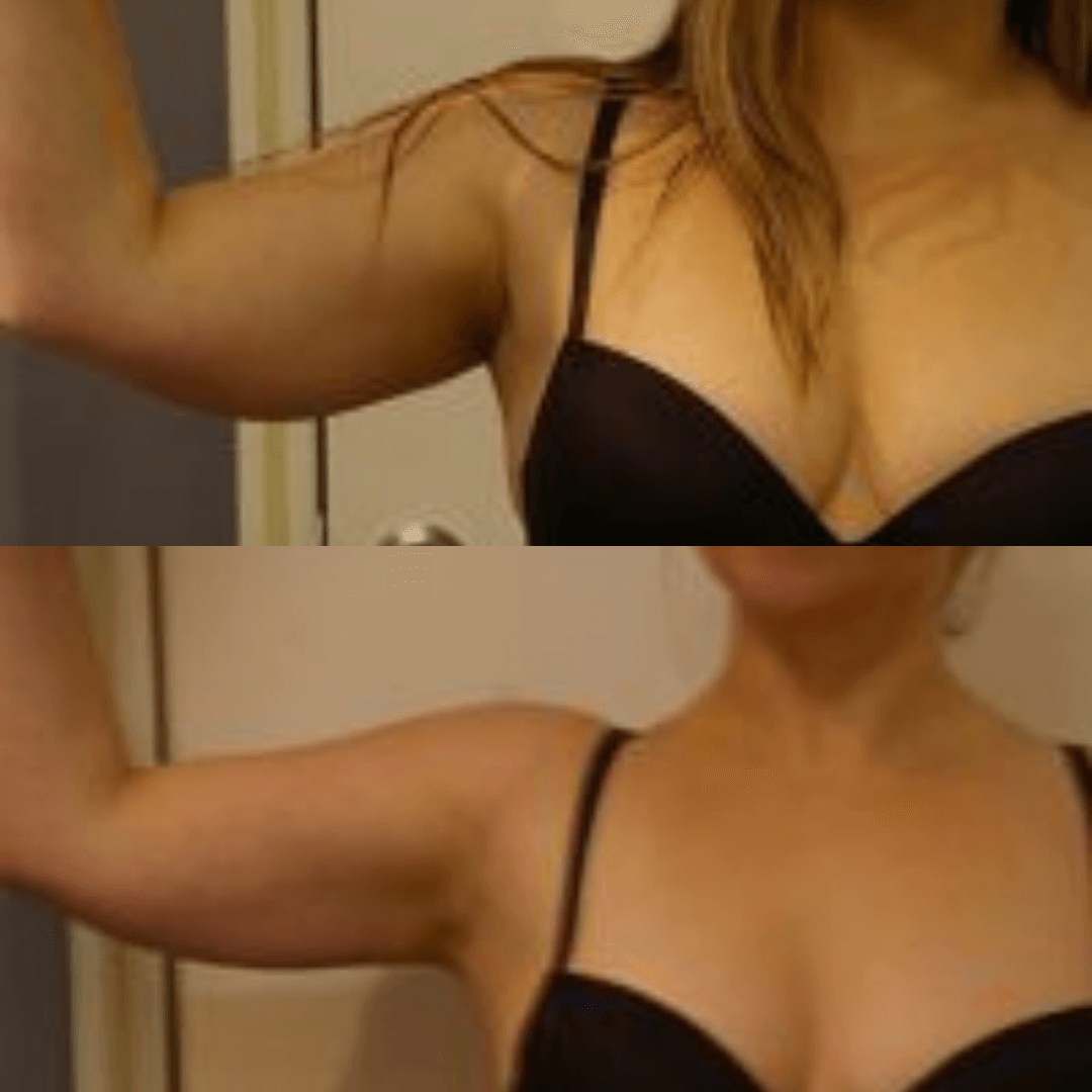 arms women